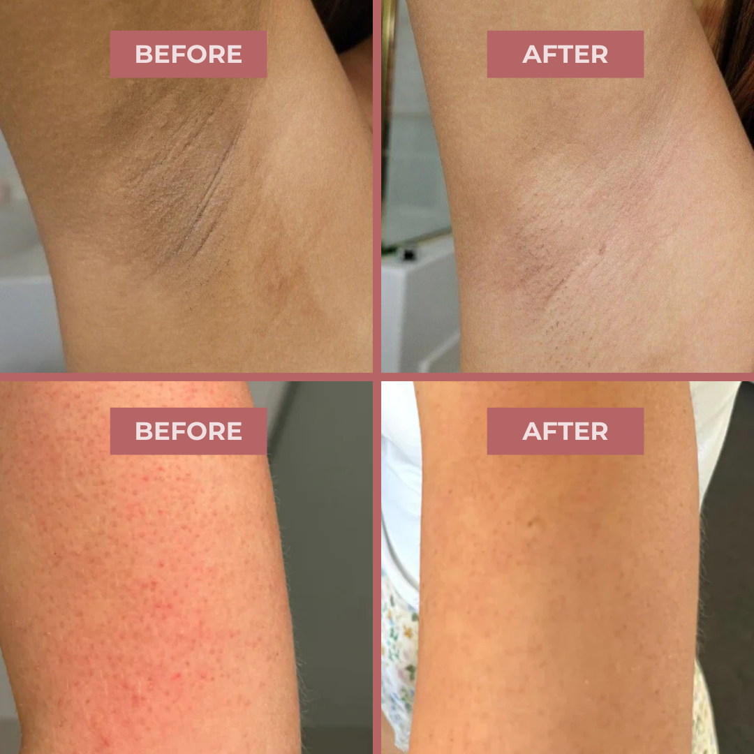 Kojic Acid Turmeric Spray