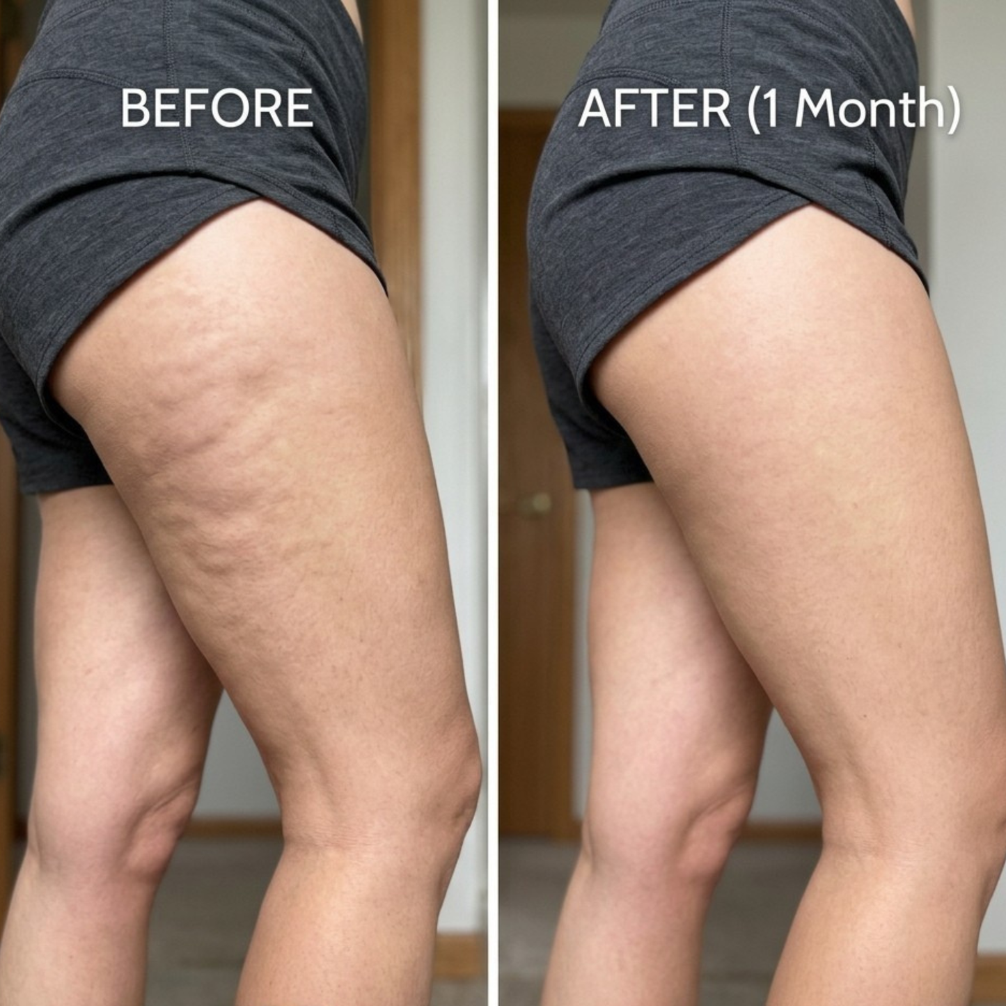 Anti Cellulite Gold Gel
