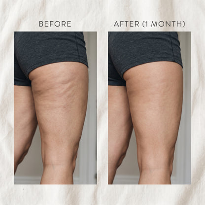 Anti Cellulite Gold Gel